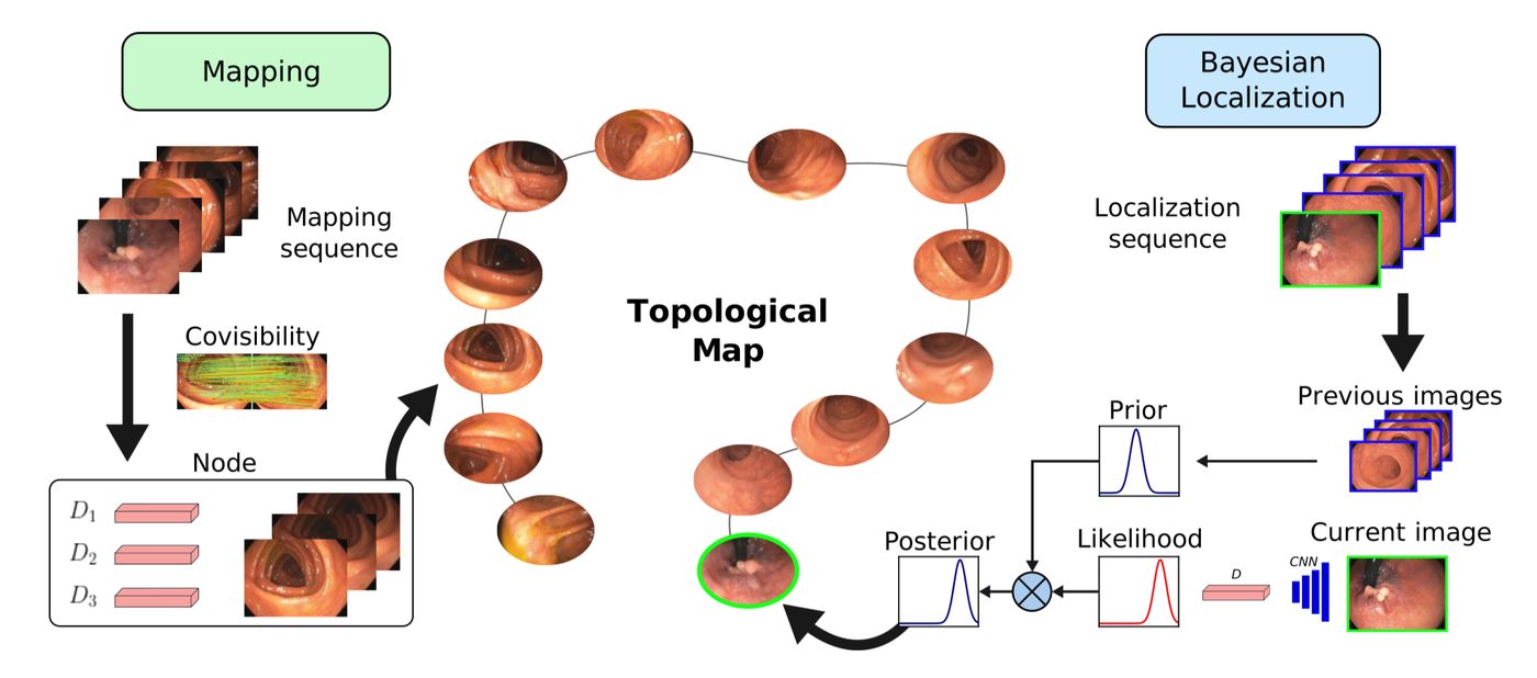 ColonMapper: a topological map of the colon is built from one sequence, then a second sequence is localized against it.