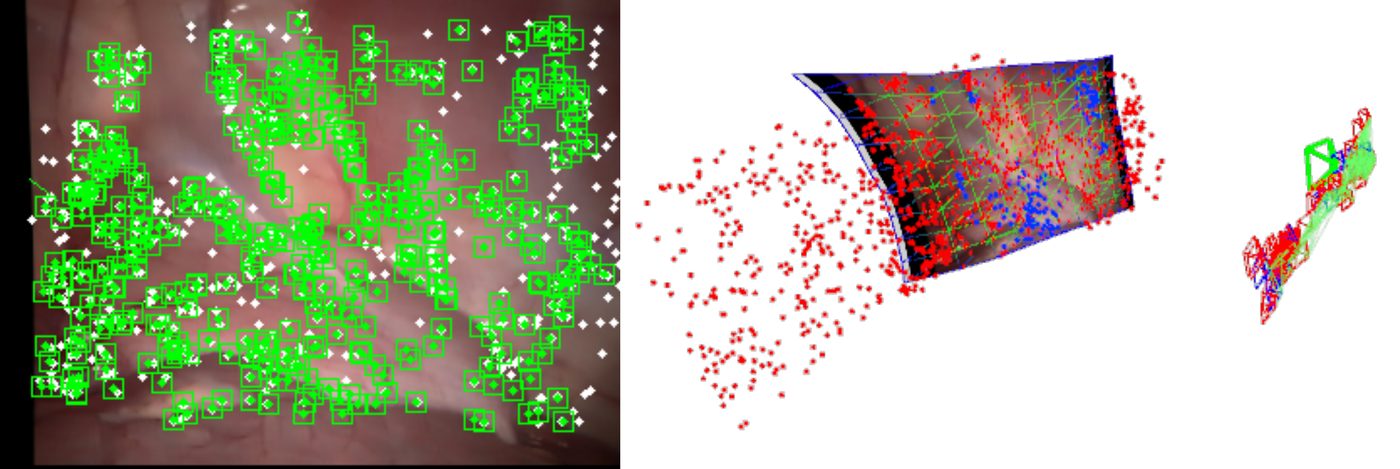 SD-DefSLAM: semi-direct monocular SLAM tracking a deforming intracorporeal scene.
